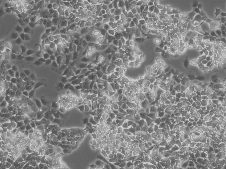 SNU-761 epithelioid cells人肝癌细胞系,SNU-761 epithelioid cells