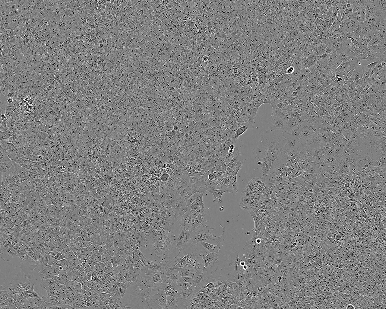 TGW epithelioid cells人神经母细胞瘤细胞系,TGW epithelioid cells