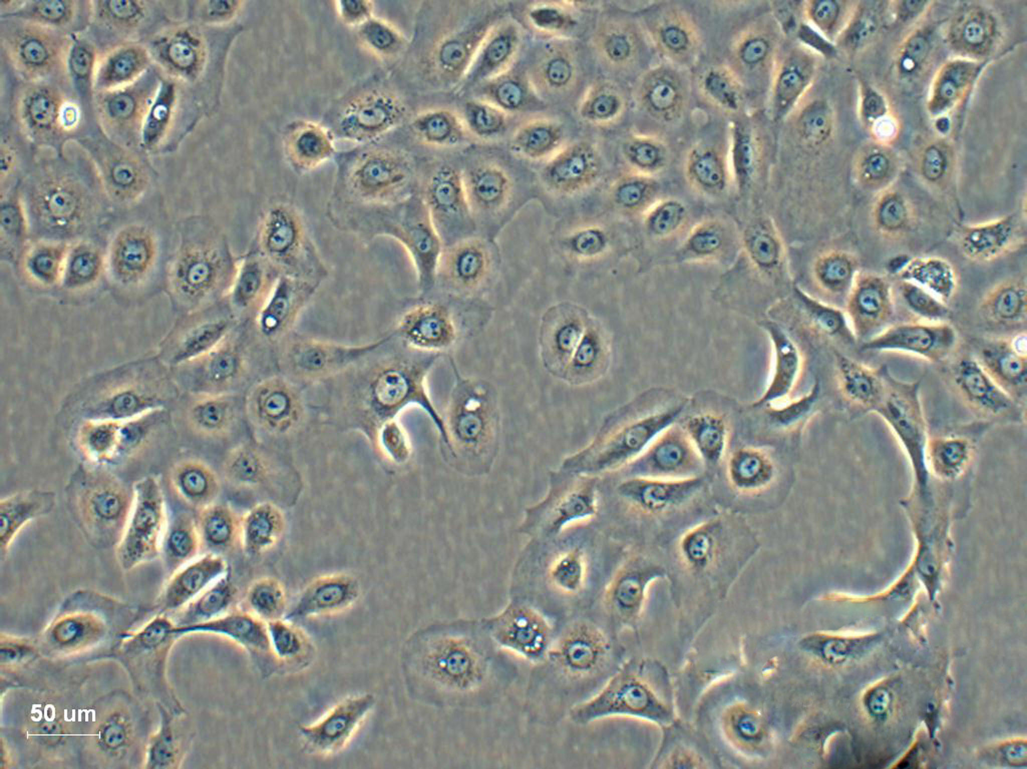 HEI193 epithelioid cells人神经鞘瘤细胞系,HEI193 epithelioid cells