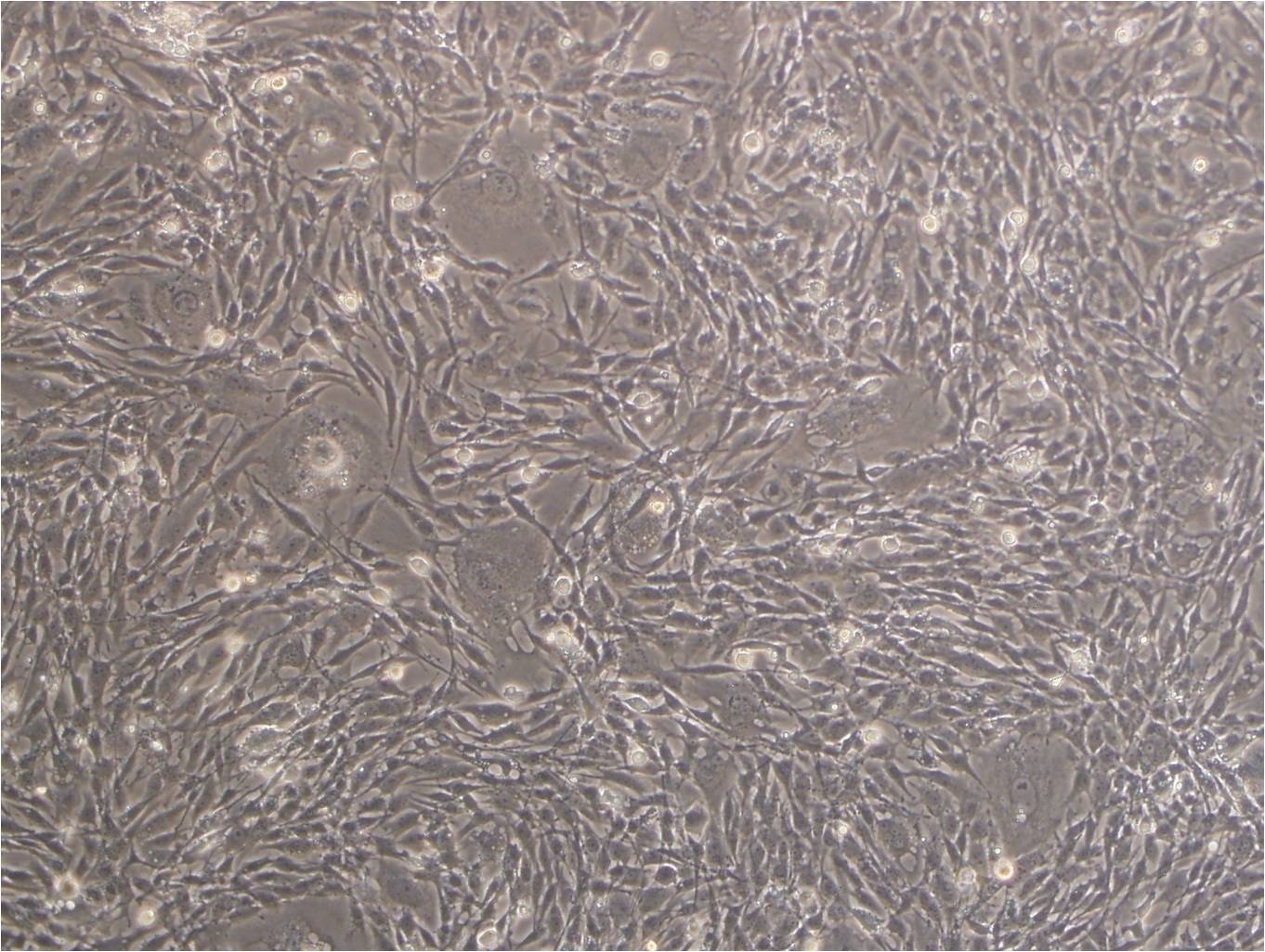 KLN205 epithelioid cells小鼠肺鳞癌细胞系,KLN205 epithelioid cells