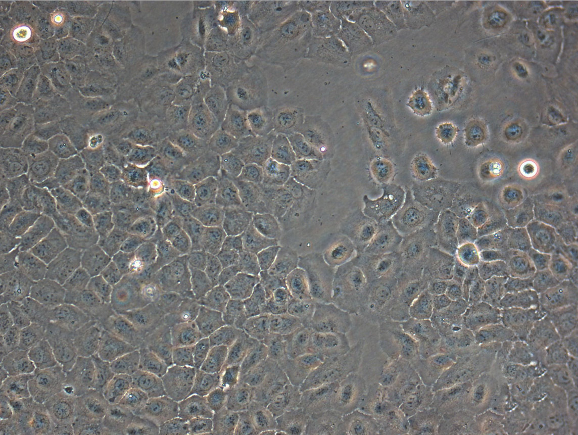 HB611 epithelioid cells人肝母細胞癌細胞系,HB611 epithelioid cells