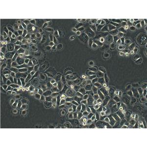 SUM159PT epithelioid cells人乳腺癌细胞系,SUM159PT epithelioid cells