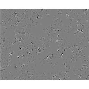 NCI-H82 epithelioid cells人小细胞肺癌细胞系
