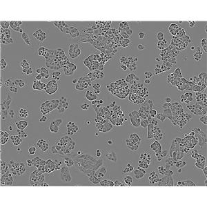 NCI-H1092 epithelioid cells人小细胞肺癌细胞系