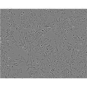 NCI-H1694 epithelioid cells人小细胞肺癌细胞系