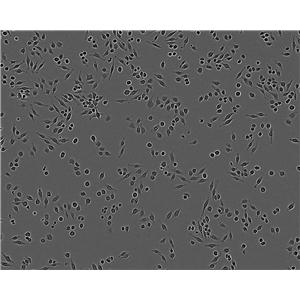 KP4 epithelioid cells人胰腺癌细胞系,KP4 epithelioid cells