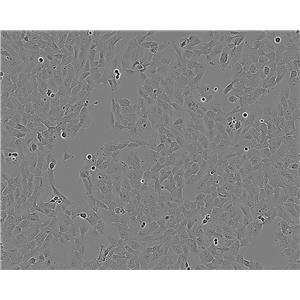 NCM356 epithelioid cells结直肠腺癌细胞系,NCM356 epithelioid cells