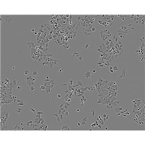 PE/CA-PJ34 (clone C12) epithelioid cells人口腔鳞状细胞癌细胞系