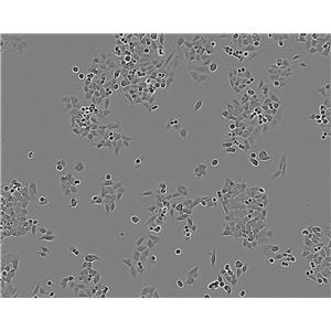 TE-15 epithelioid cells人食管癌細(xì)胞系