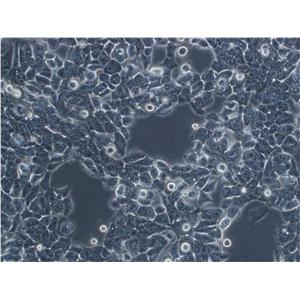 Clone M-3 epithelioid cells小鼠黑色素瘤细胞系