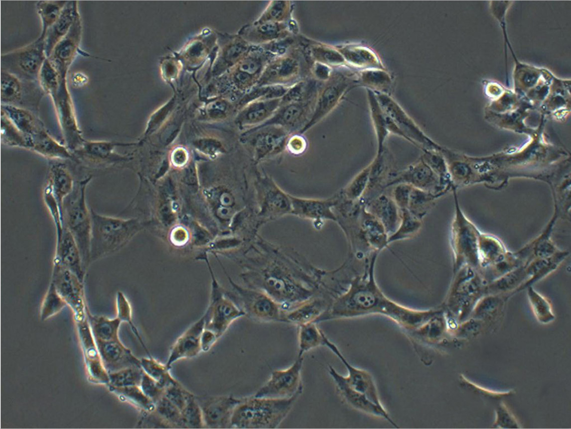 COR-L279 epithelioid cells人肺小細(xì)胞癌細(xì)胞系,COR-L279 epithelioid cells