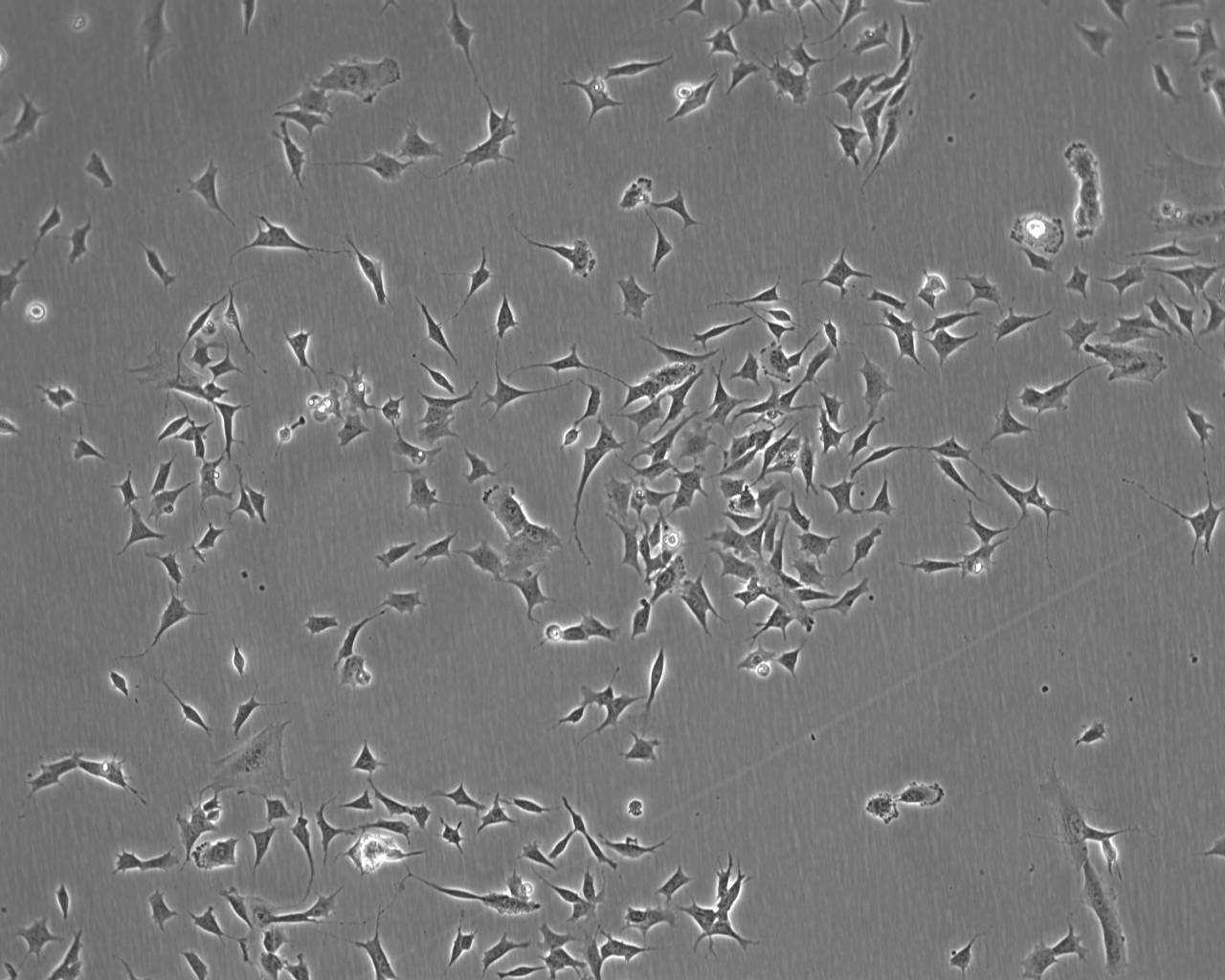 SNU-216 epithelioid cells人胃癌细胞系,SNU-216 epithelioid cells