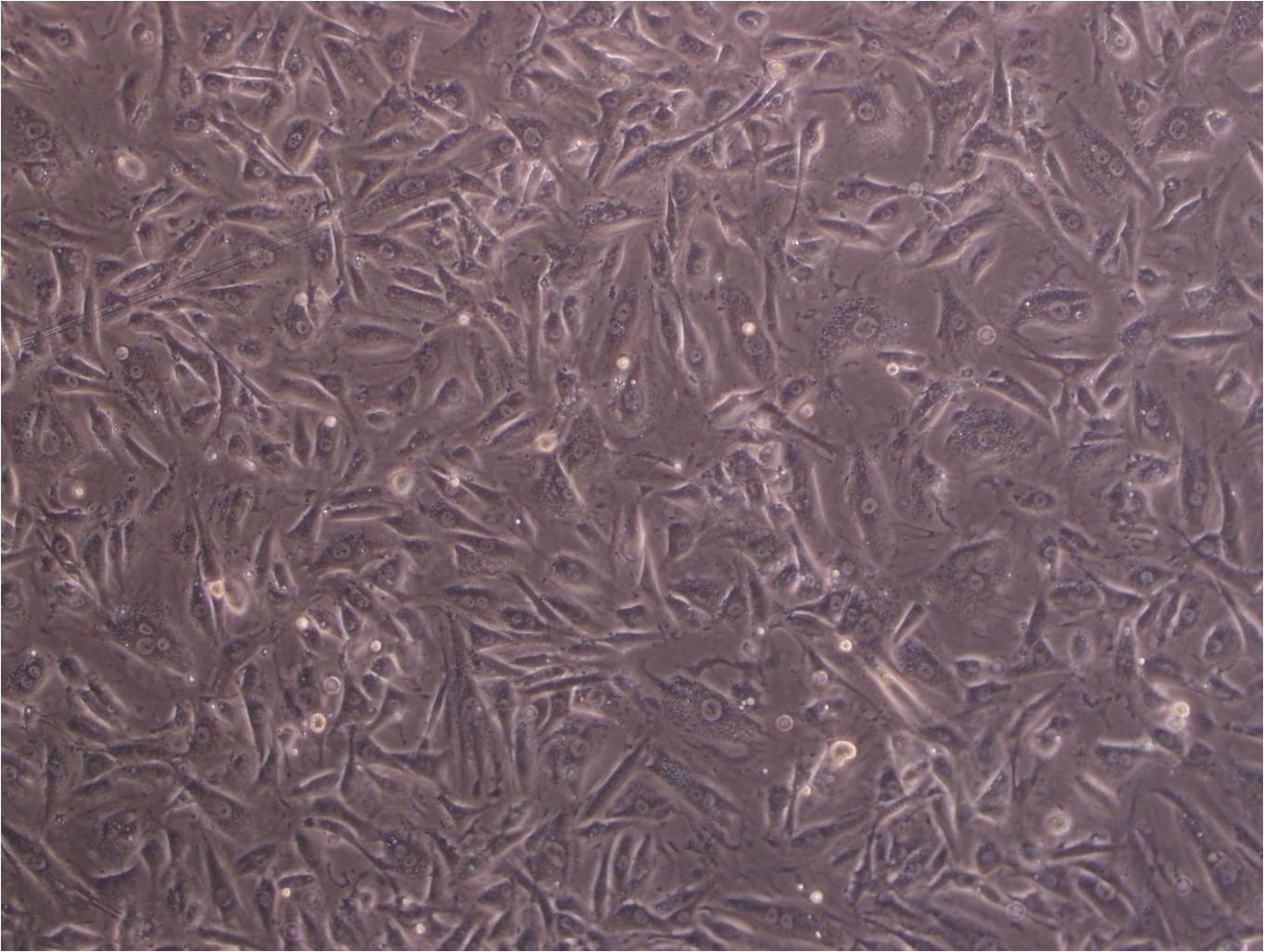 KYSE-140 epithelioid cells人食管鳞癌细胞系,KYSE-140 epithelioid cells