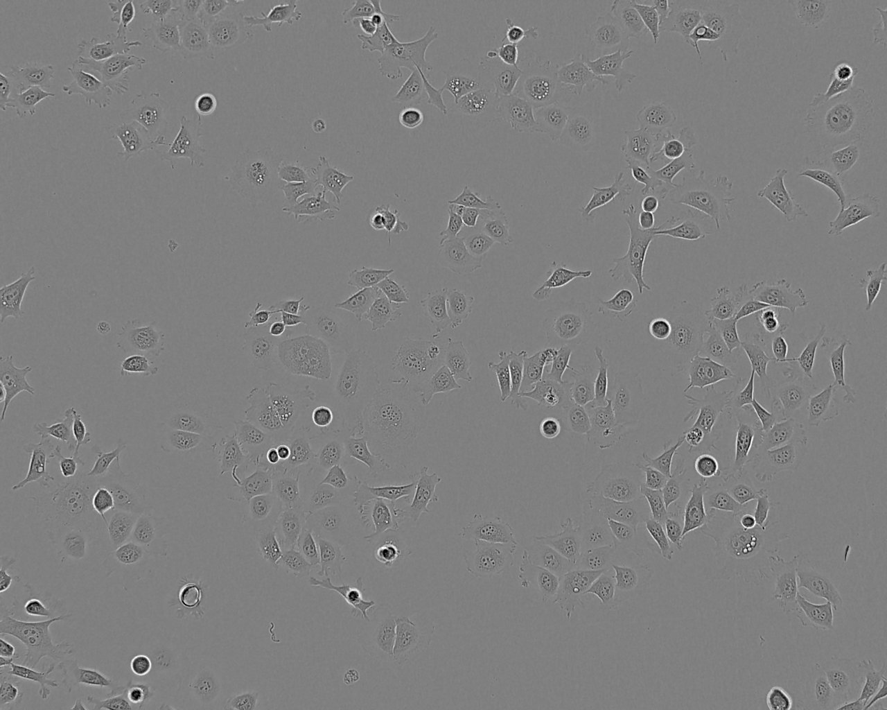 KYSE-50 epithelioid cells低分化人食管鳞癌细胞系,KYSE-50 epithelioid cells