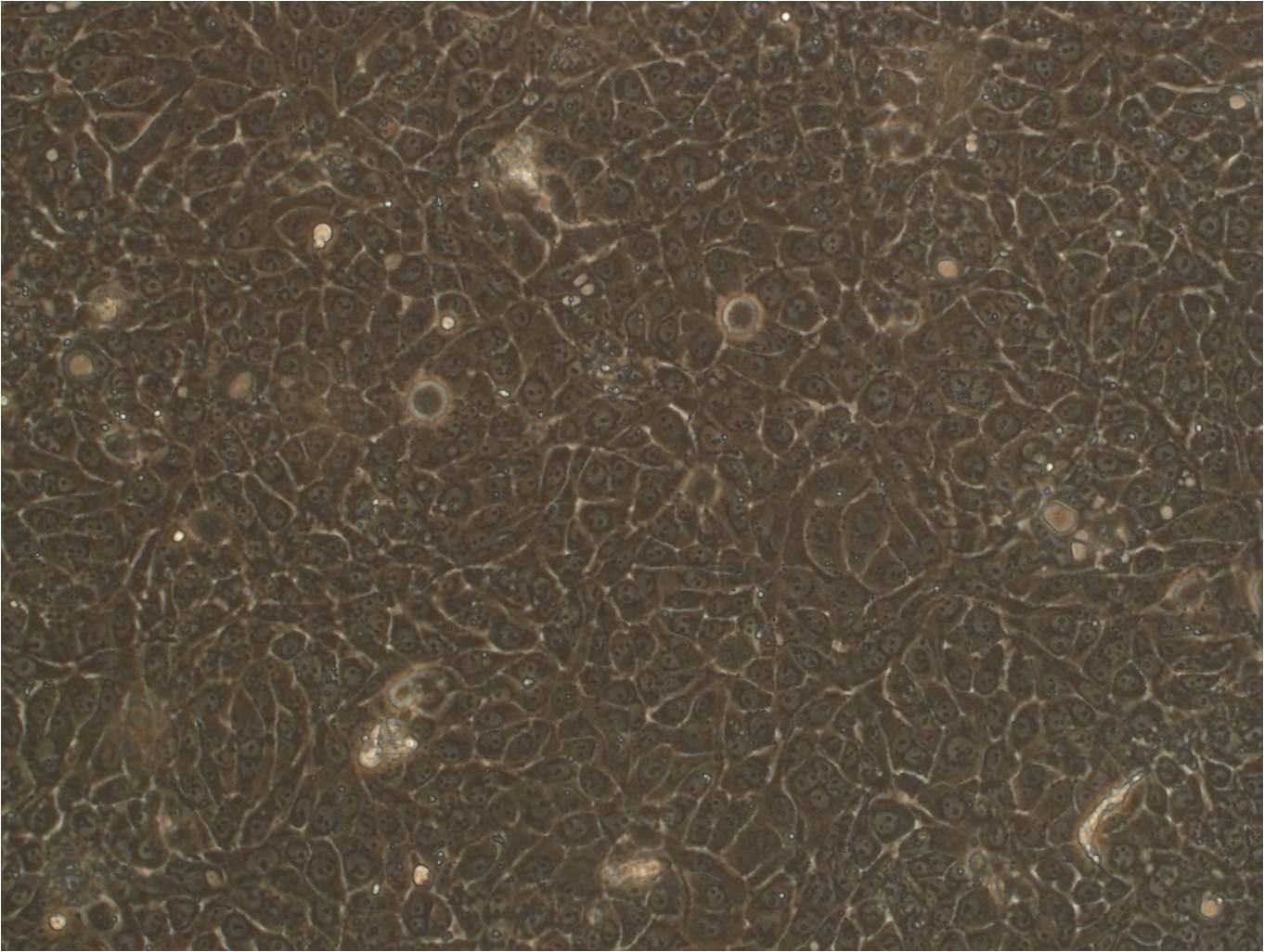 OCM-1A epithelioid cells人脉络膜黑色素瘤细胞系,OCM-1A epithelioid cells