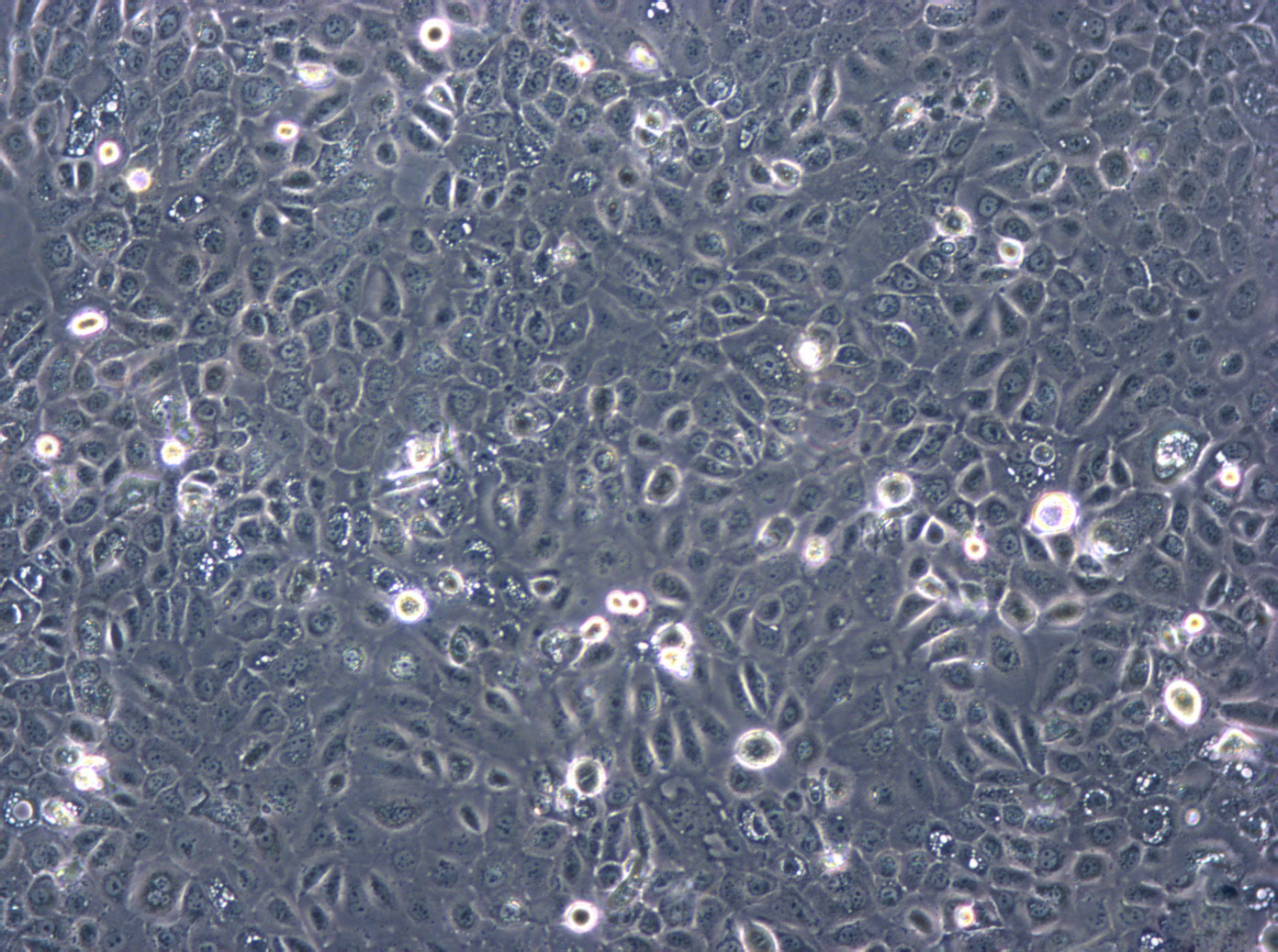 RCC4 epithelioid cells人肾癌细胞系,RCC4 epithelioid cells