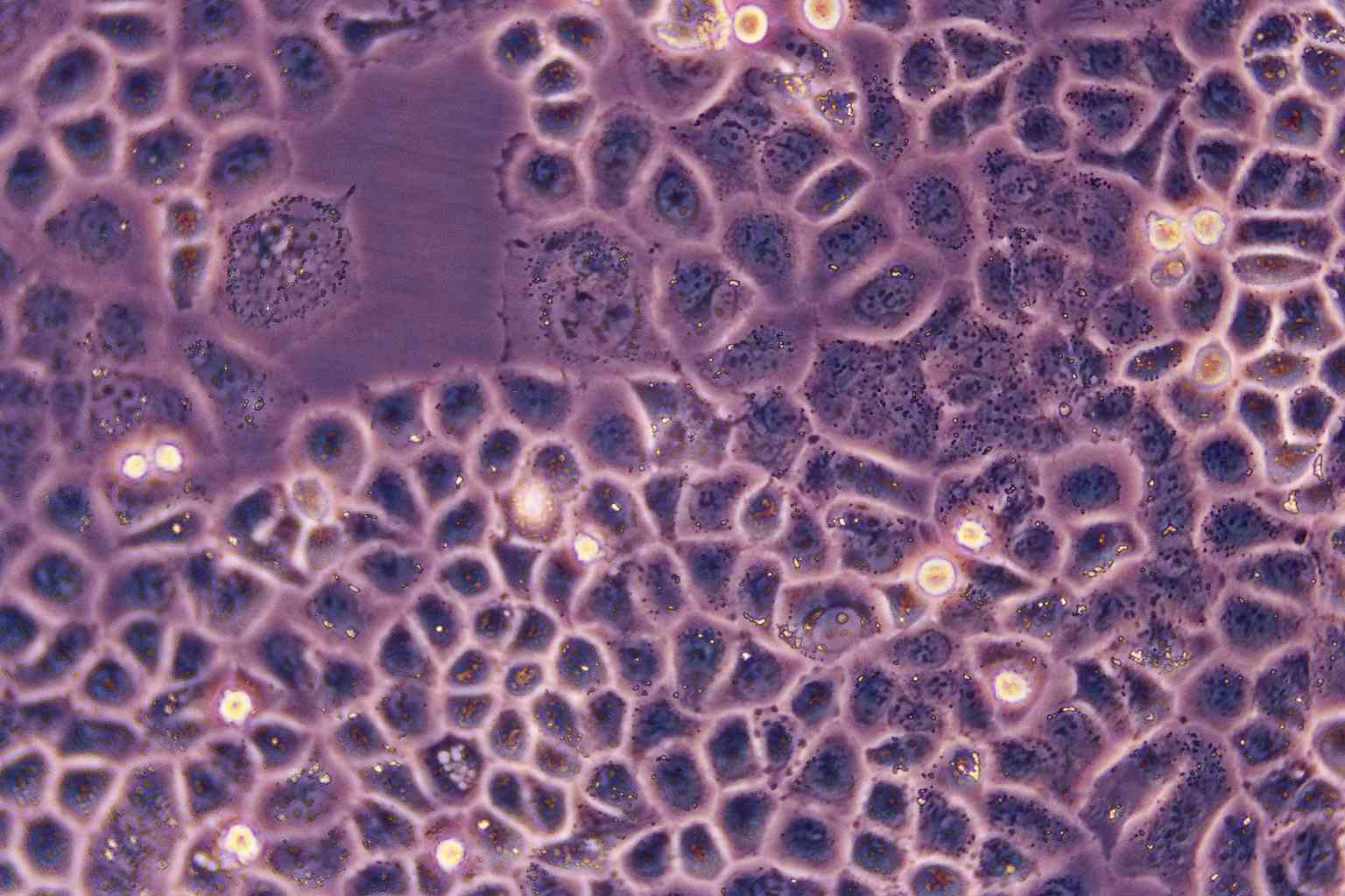 Rca-B epithelioid cells大鼠鳞癌细胞系,Rca-B epithelioid cells