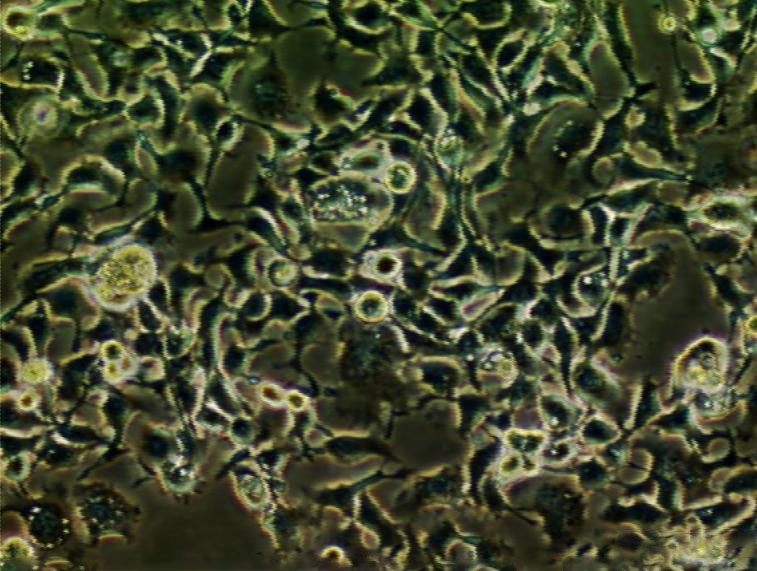 CSQT-2 epithelioid cells人肝癌细胞系,CSQT-2 epithelioid cells