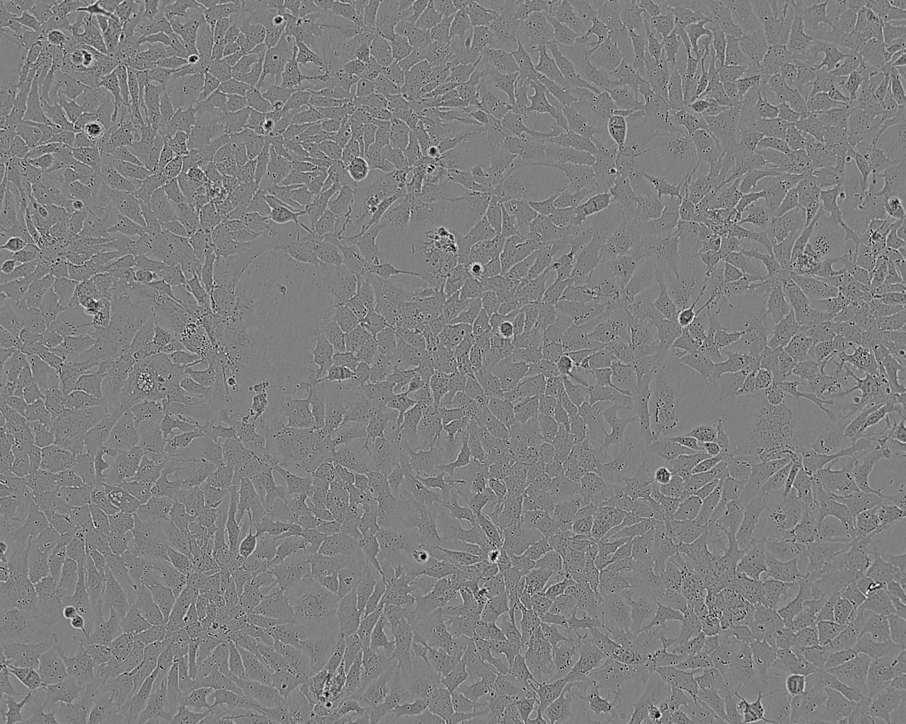 MM96L epithelioid cells人黑色素瘤细胞系,MM96L epithelioid cells