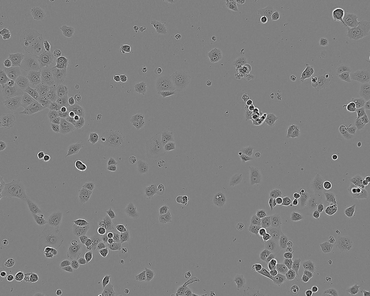 HHUA epithelioid cells人子宮內(nèi)膜癌細(xì)胞系,HHUA epithelioid cells