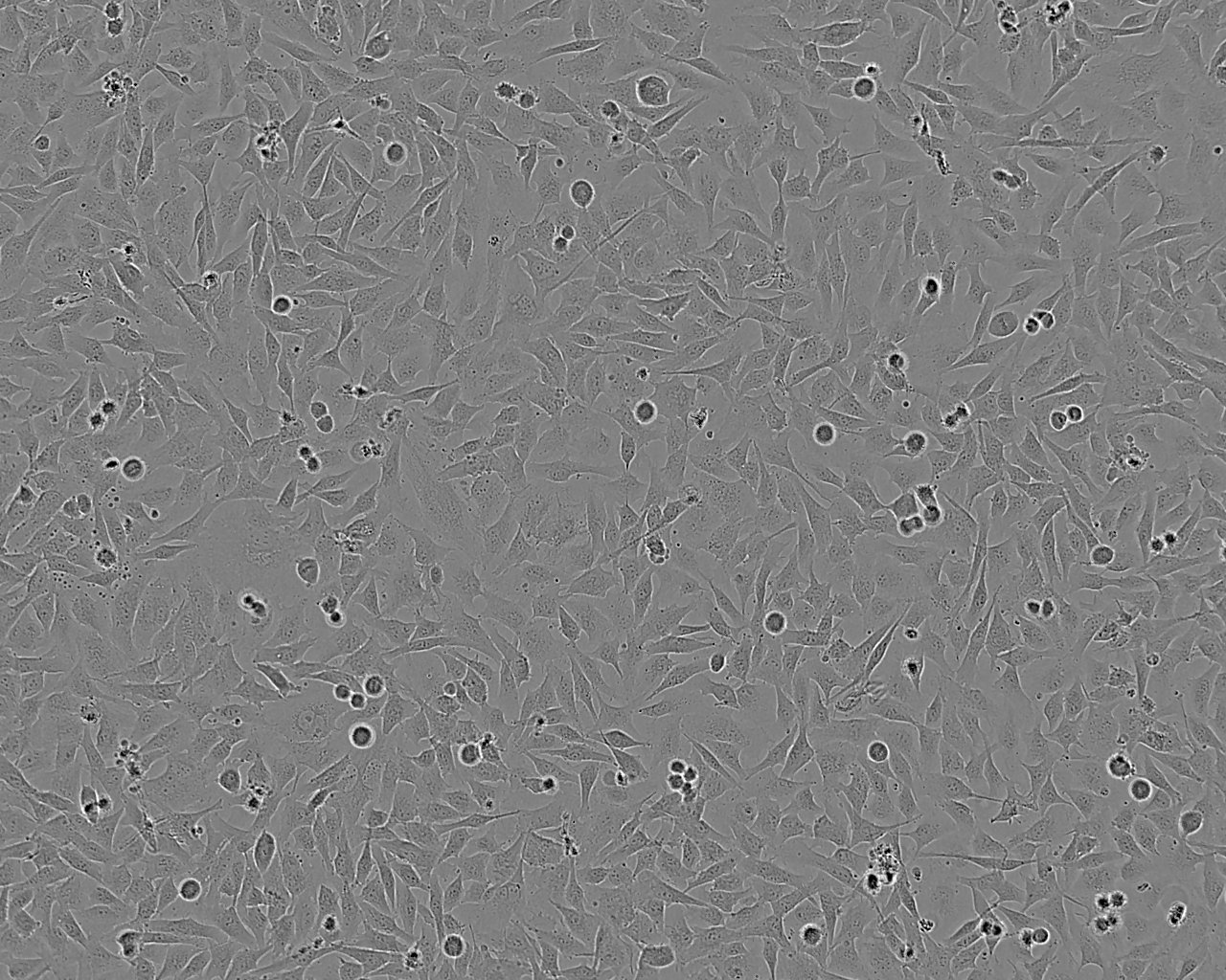 HTh74 epithelioid cells人未分化甲狀腺癌細(xì)胞系,HTh74 epithelioid cells