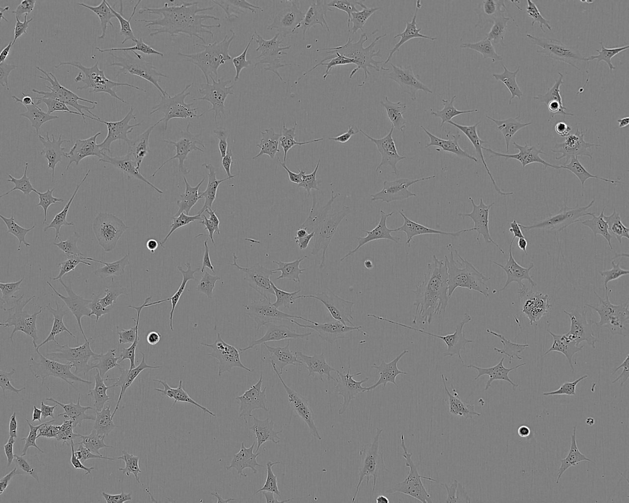 NUGC-4 epithelioid cells人胃癌细胞系,NUGC-4 epithelioid cells