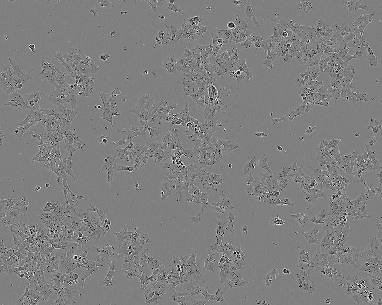 SW1088 epithelioid cells人腦星形膠質(zhì)瘤細(xì)胞系,SW1088 epithelioid cells