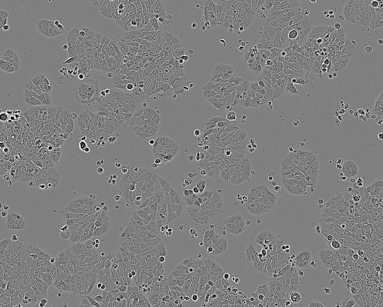 Tu 177 epithelioid cells人喉鳞癌细胞系,Tu 177 epithelioid cells