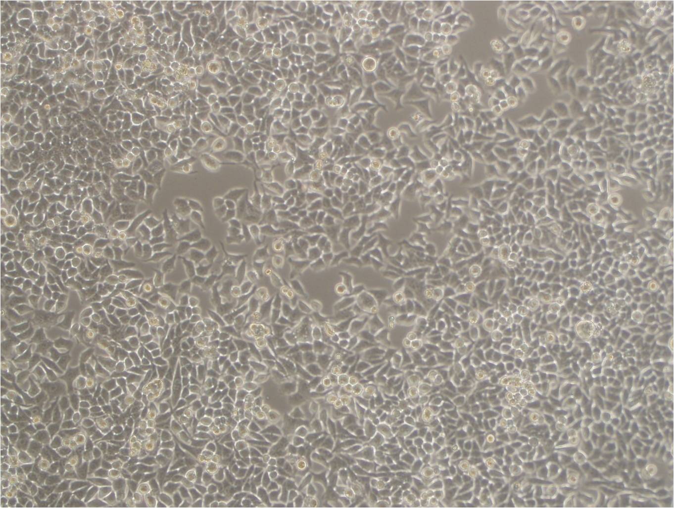 HEY A8 epithelioid cells人卵巢癌細(xì)胞系,HEY A8 epithelioid cells