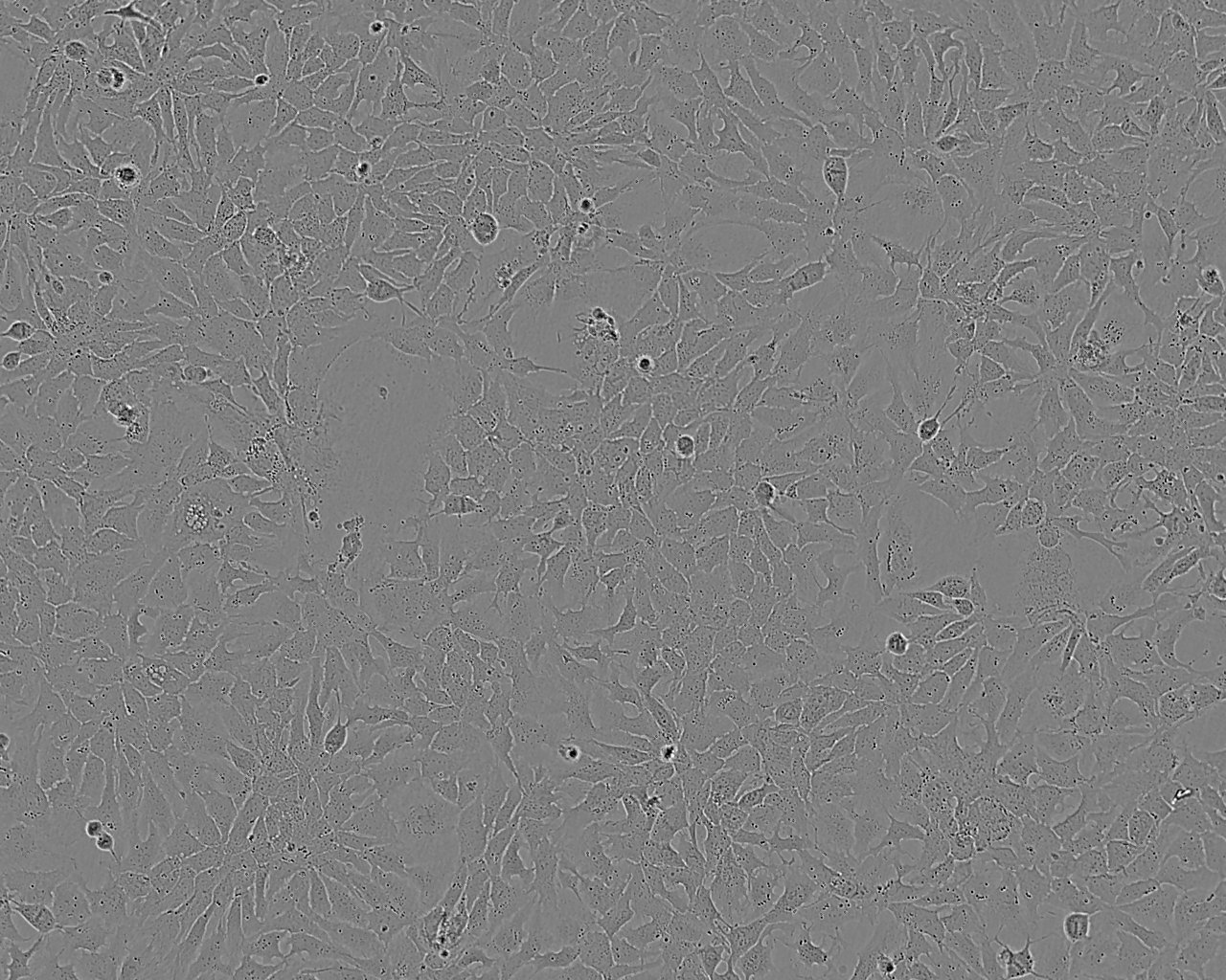 QGP-1 epithelioid cells人胰腺癌细胞系,QGP-1 epithelioid cells