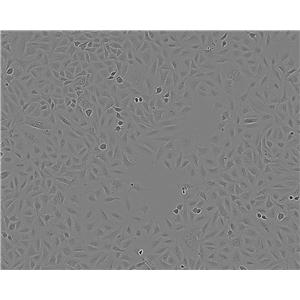 HOP-92 epithelioid cells人小细胞肺癌细胞系