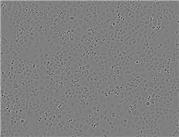 TU 686 epithelioid cells人喉癌细胞系