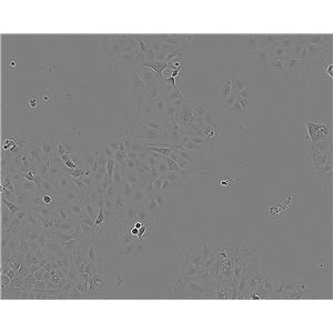 KMB-17 epithelioid cells人二倍体细胞系,KMB-17 epithelioid cells