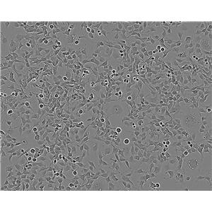 HT-3 epithelioid cells人子宫颈癌细胞系