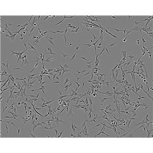 NCTC 1469 epithelioid cells小鼠正常肝细胞系,NCTC 1469 epithelioid cells