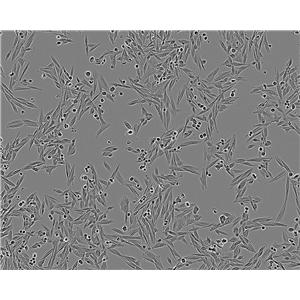 SW1353 epithelioid cells人软骨肉瘤细胞系