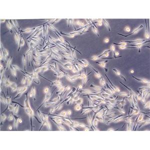 NS20Y epithelioid cells小鼠神经母细胞瘤细胞系