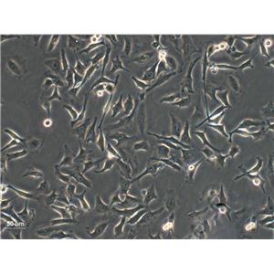 LAPC-4 epithelioid cells人前列腺癌细胞系,LAPC-4 epithelioid cells