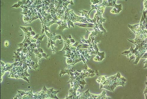 KM12-SM epithelioid cells人结肠癌肝转移细胞系,KM12-SM epithelioid cells
