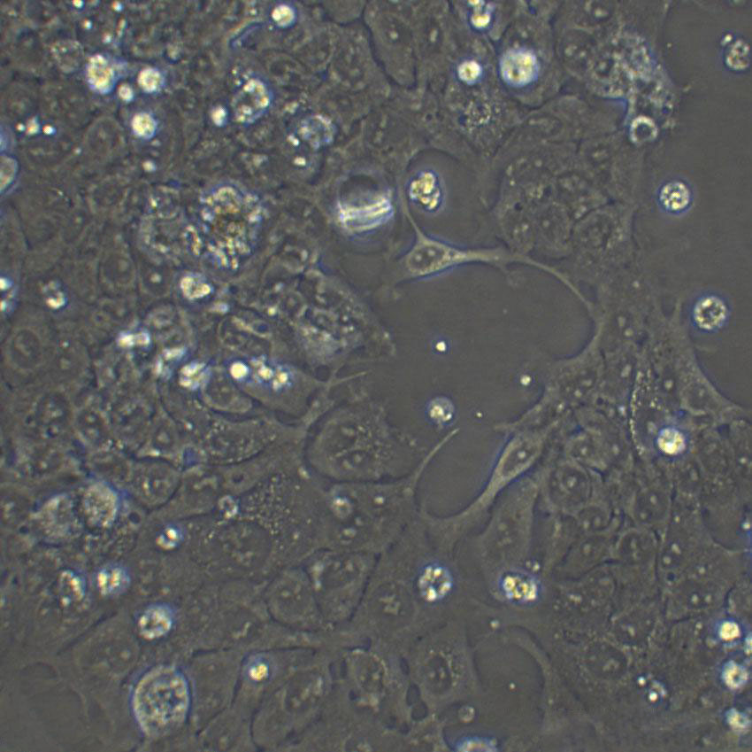 MCF-10A epithelioid cells人正常乳腺上皮细胞系,MCF-10A epithelioid cells