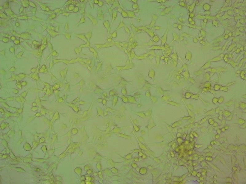 CAL-39 epithelioid cells人外阴鳞癌细胞系,CAL-39 epithelioid cells