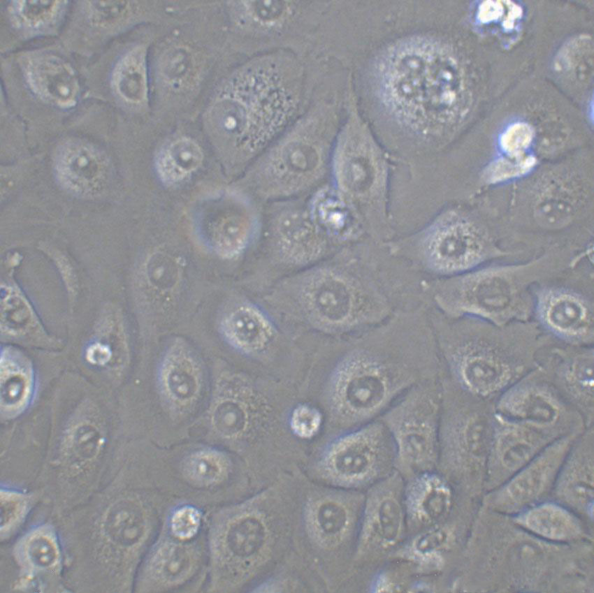 KMM-1 epithelioid cells人多发性骨髓瘤细胞系,KMM-1 epithelioid cells