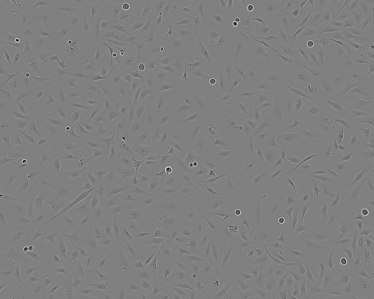 67NR epithelioid cells小鼠乳腺癌细胞系,67NR epithelioid cells