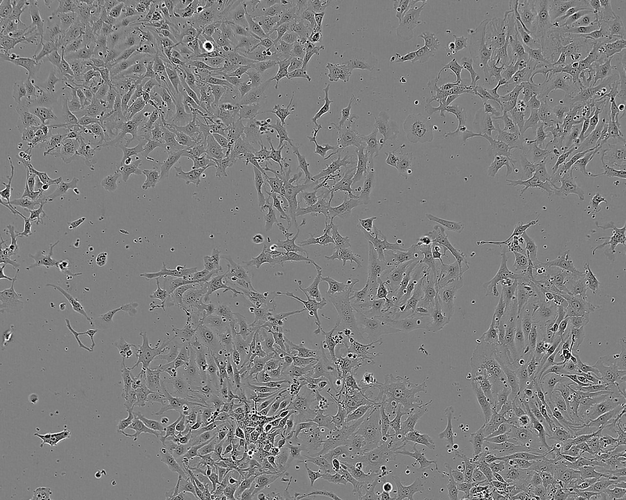 HCC2279 epithelioid cells人肺腺鳞癌细胞系,HCC2279 epithelioid cells