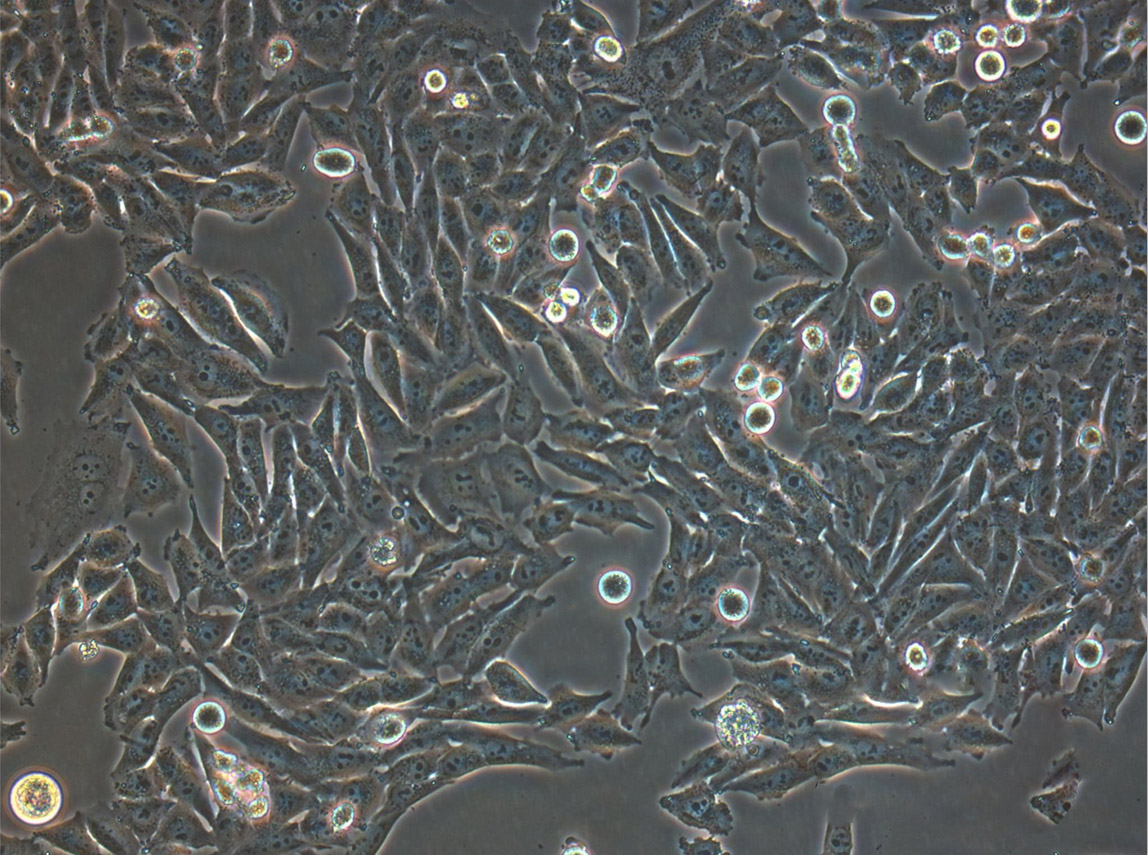 MPC-5 epithelioid cells小鼠肾足细胞系,MPC-5 epithelioid cells