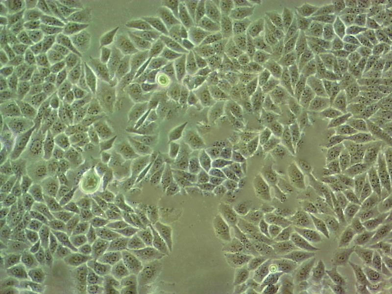 KYSE-180 epithelioid cells人食管鱗癌細(xì)胞系,KYSE-180 epithelioid cells