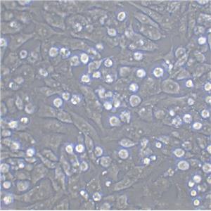 CPAE epithelioid cells牛肺血管内皮细胞系