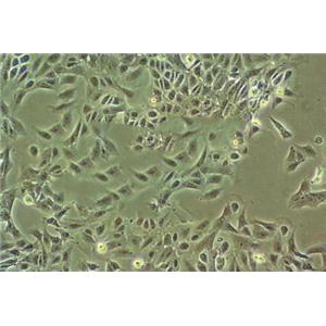 Mahlavu epithelioid cells人肝癌细胞系