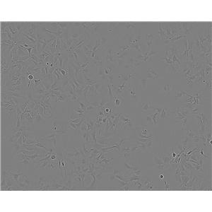 VMM39 epithelioid cells人黑色素瘤细胞系
