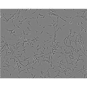 B104 [Rat neuroblastoma] epithelioid cells大鼠神經(jīng)母細胞瘤細胞系